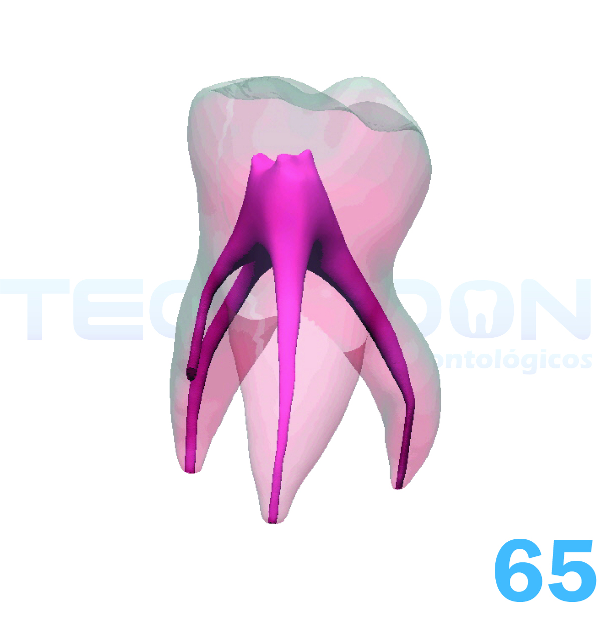 2° Molar Superior Decíduo Transparente - Imagem 2