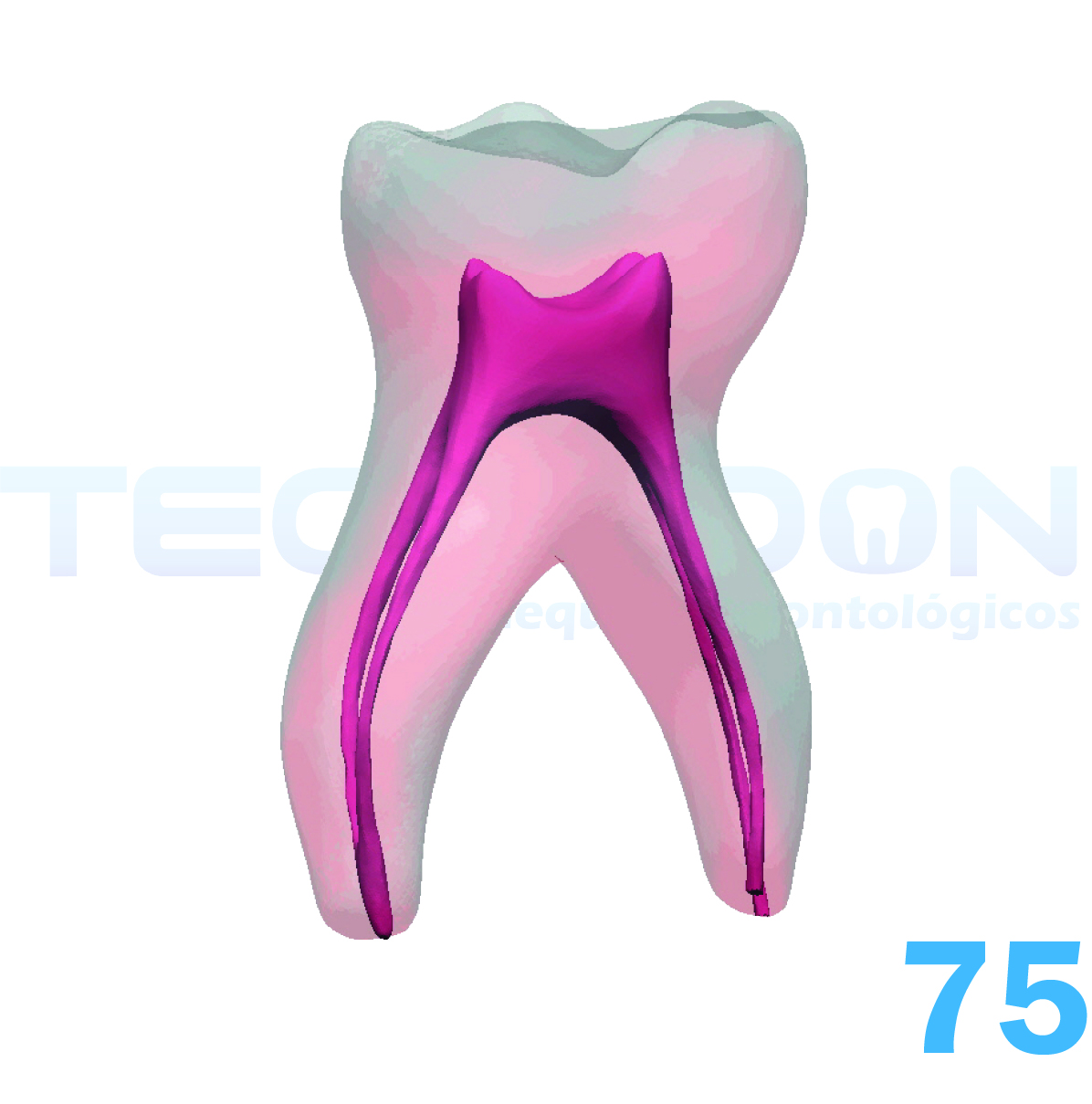 2° Molar Inferior Decíduo Transparente