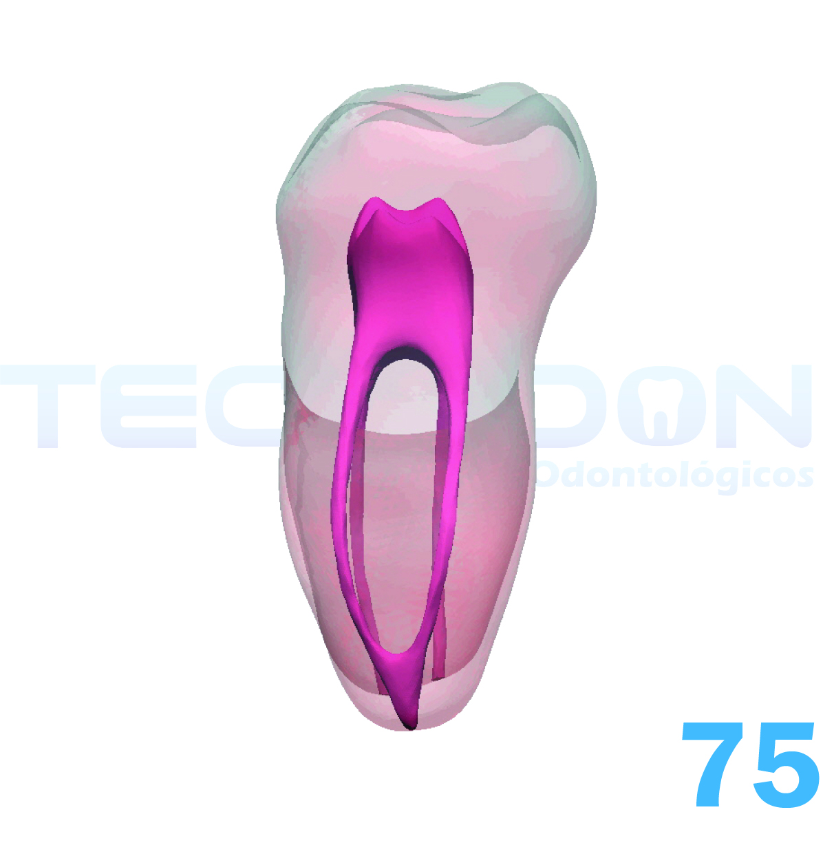 2° Molar Inferior Decíduo Opaco - Imagem 5