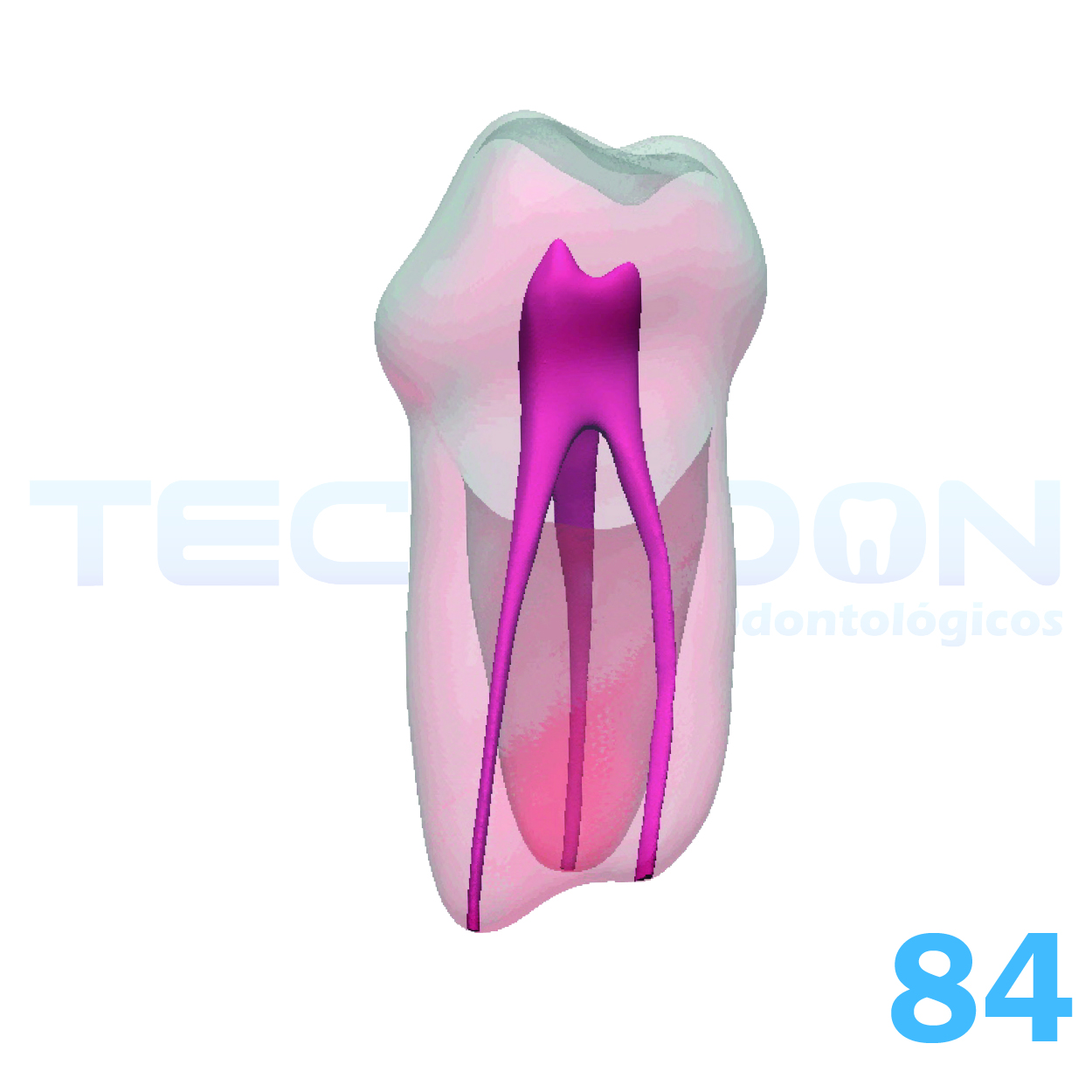 1º Molar Inferior Decíduo Opaco - Imagem 5