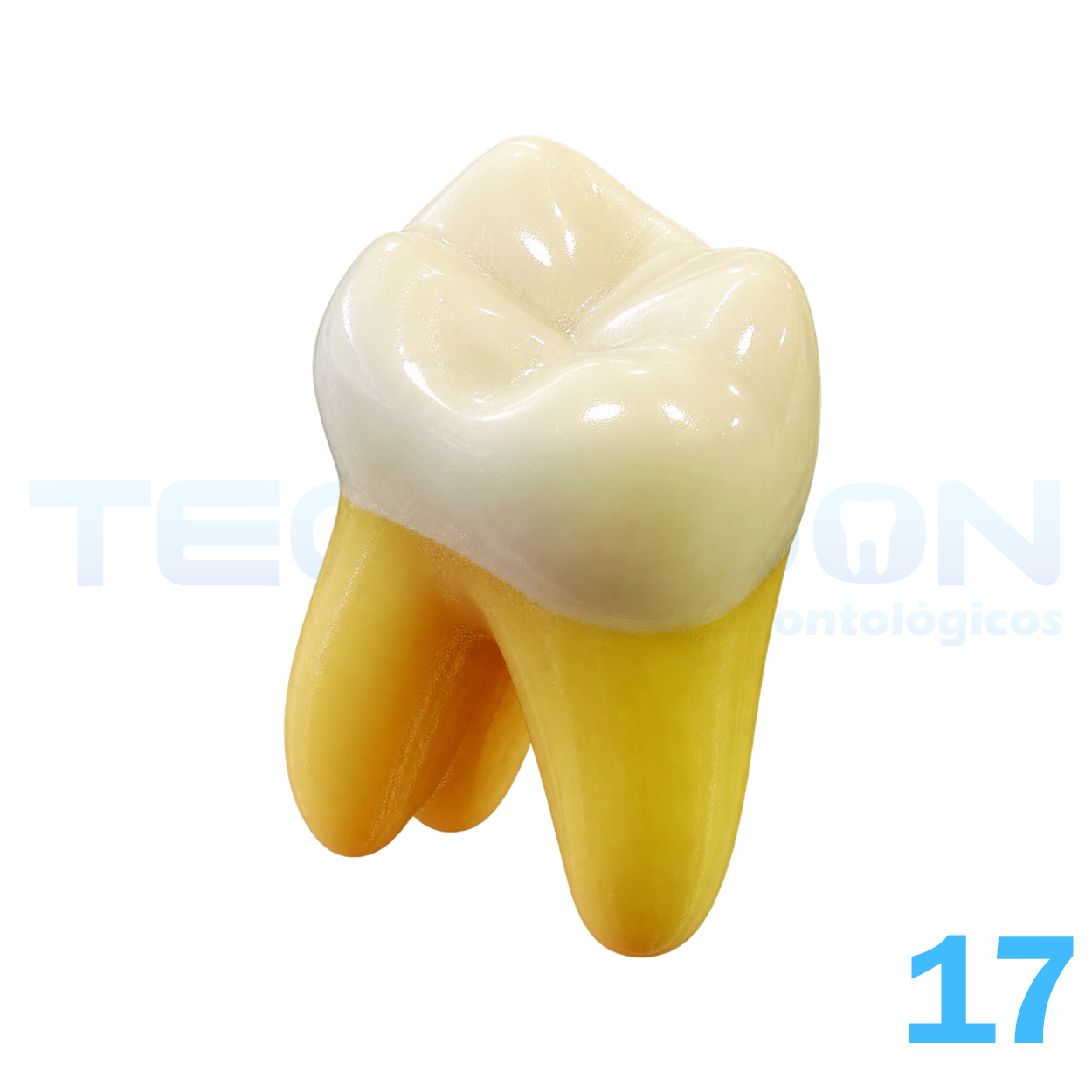 17 - 2º Molar Superior Permanente Opaco