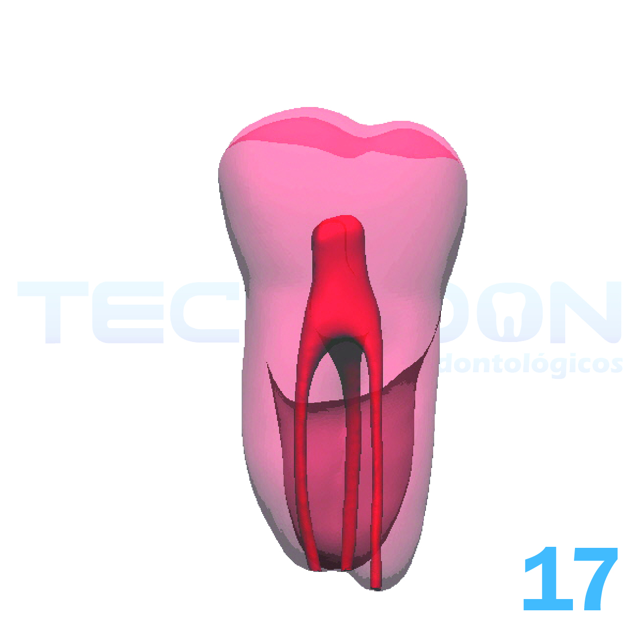 17 - 2º Molar Superior Permanente Opaco - Imagem 2