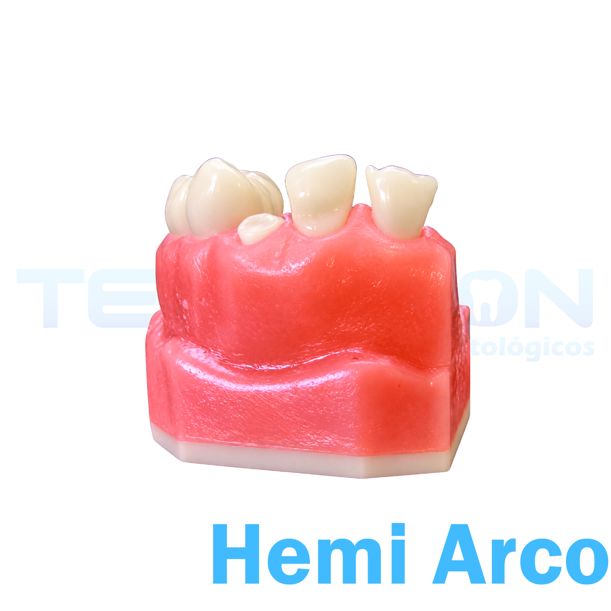 Hemi-Arco Superior Esquerdo - Imagem 3