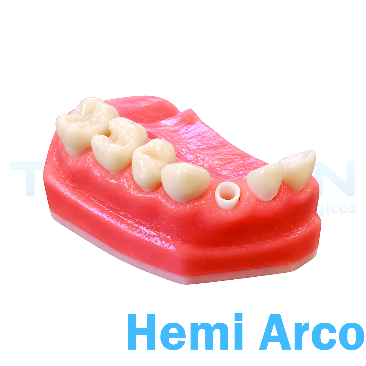 Hemi-Arco Superior Esquerdo