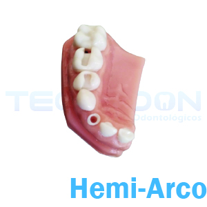Hemi-Arco Superior Esquerdo