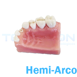 Hemi-Arco Superior Esquerdo - Imagem 2