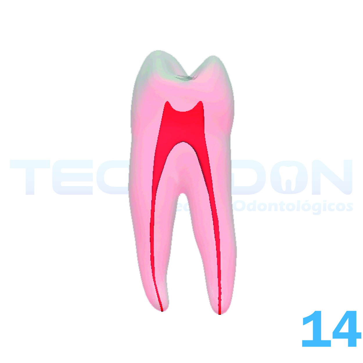14 – 1º Pré-Molar Superior Permanente Transparente